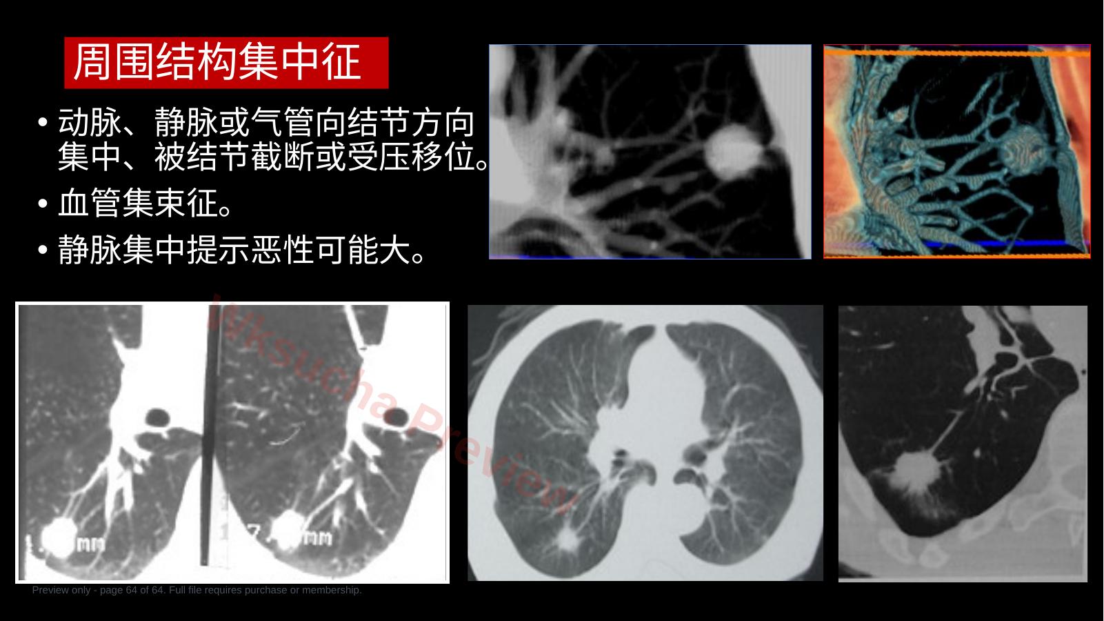 预览第 64 页