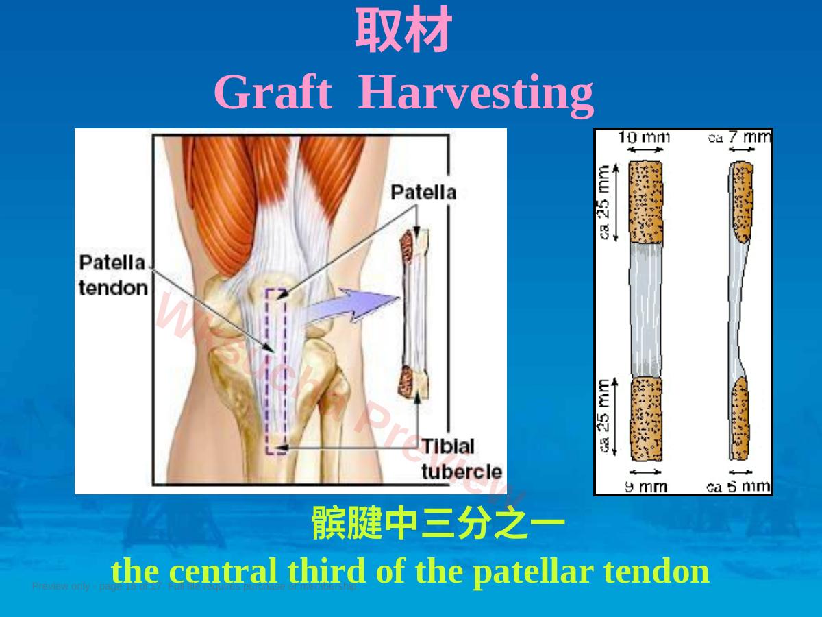 预览第 16 页