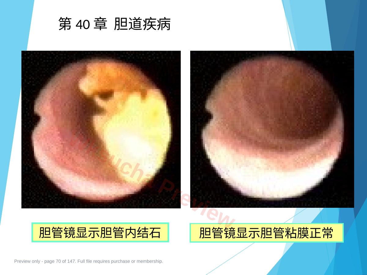 预览第 70 页