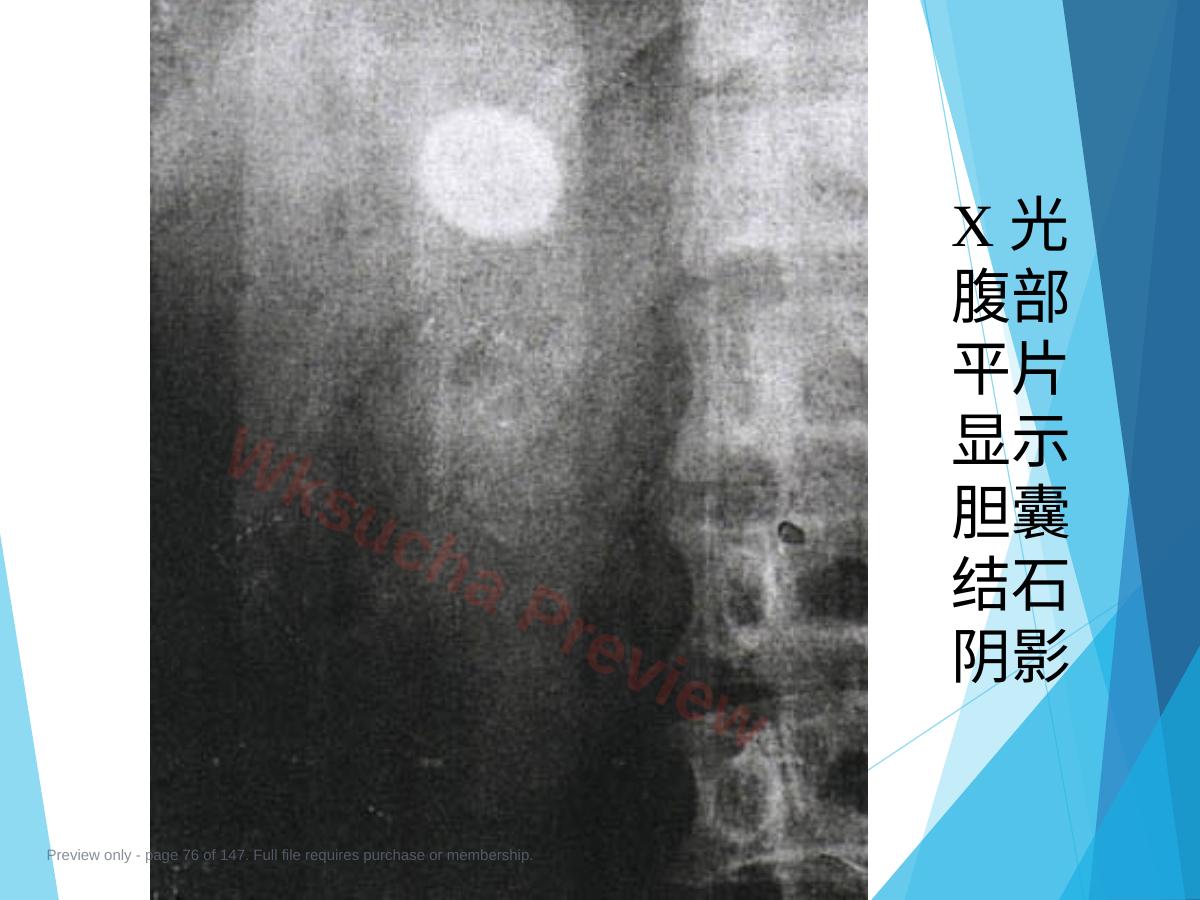 预览第 76 页