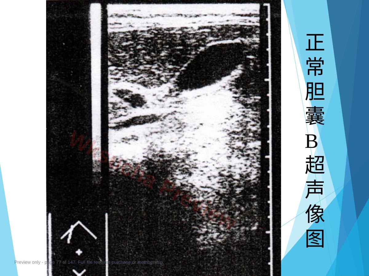 预览第 77 页