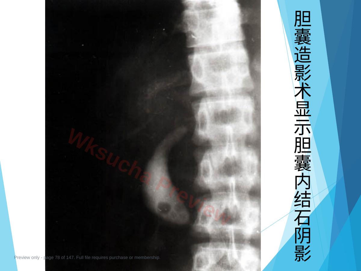预览第 78 页