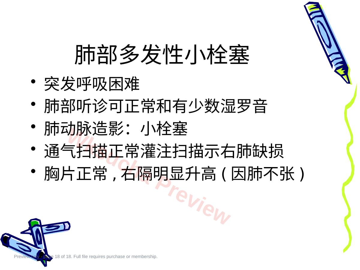 预览第 18 页