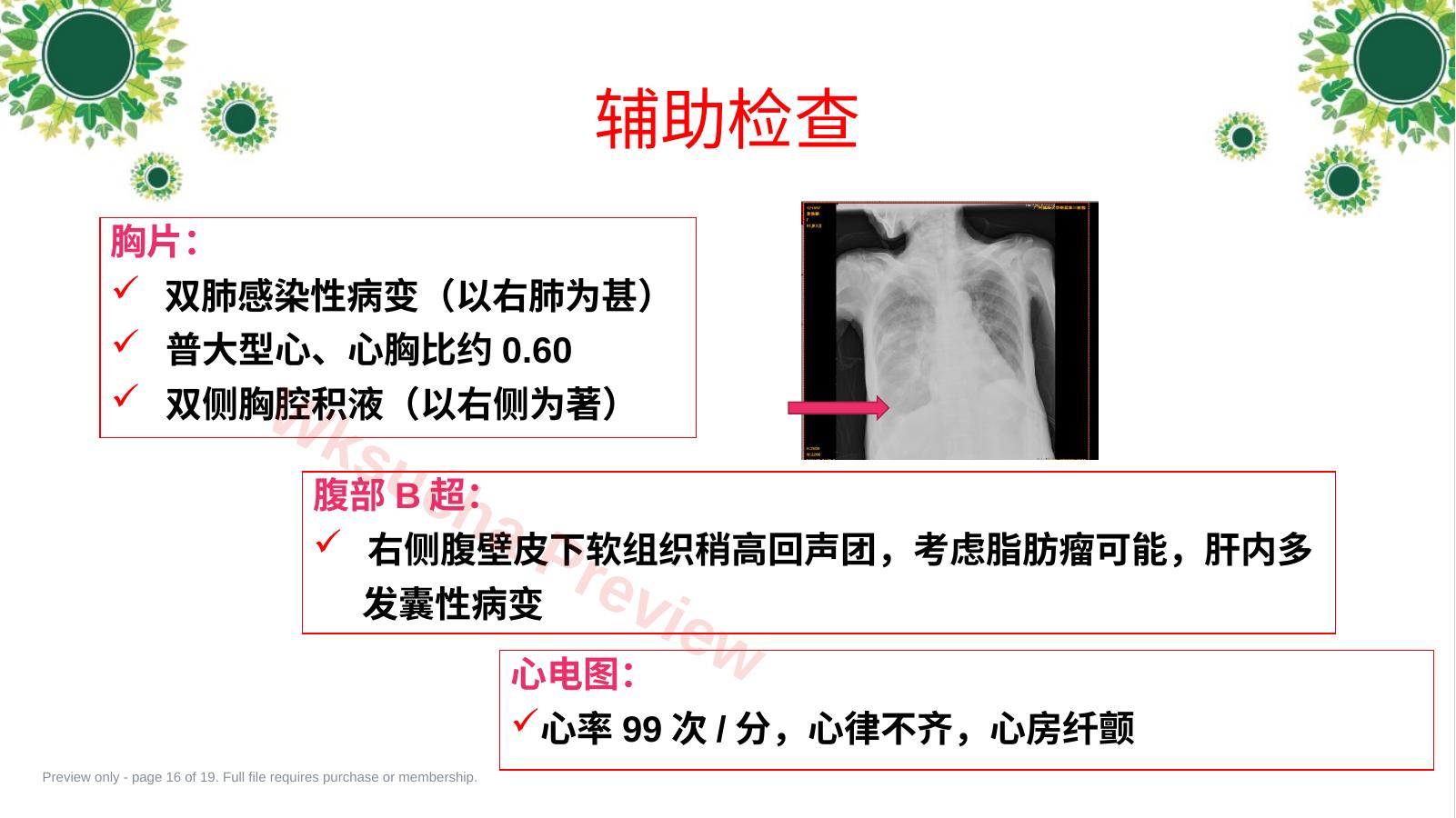 预览第 16 页