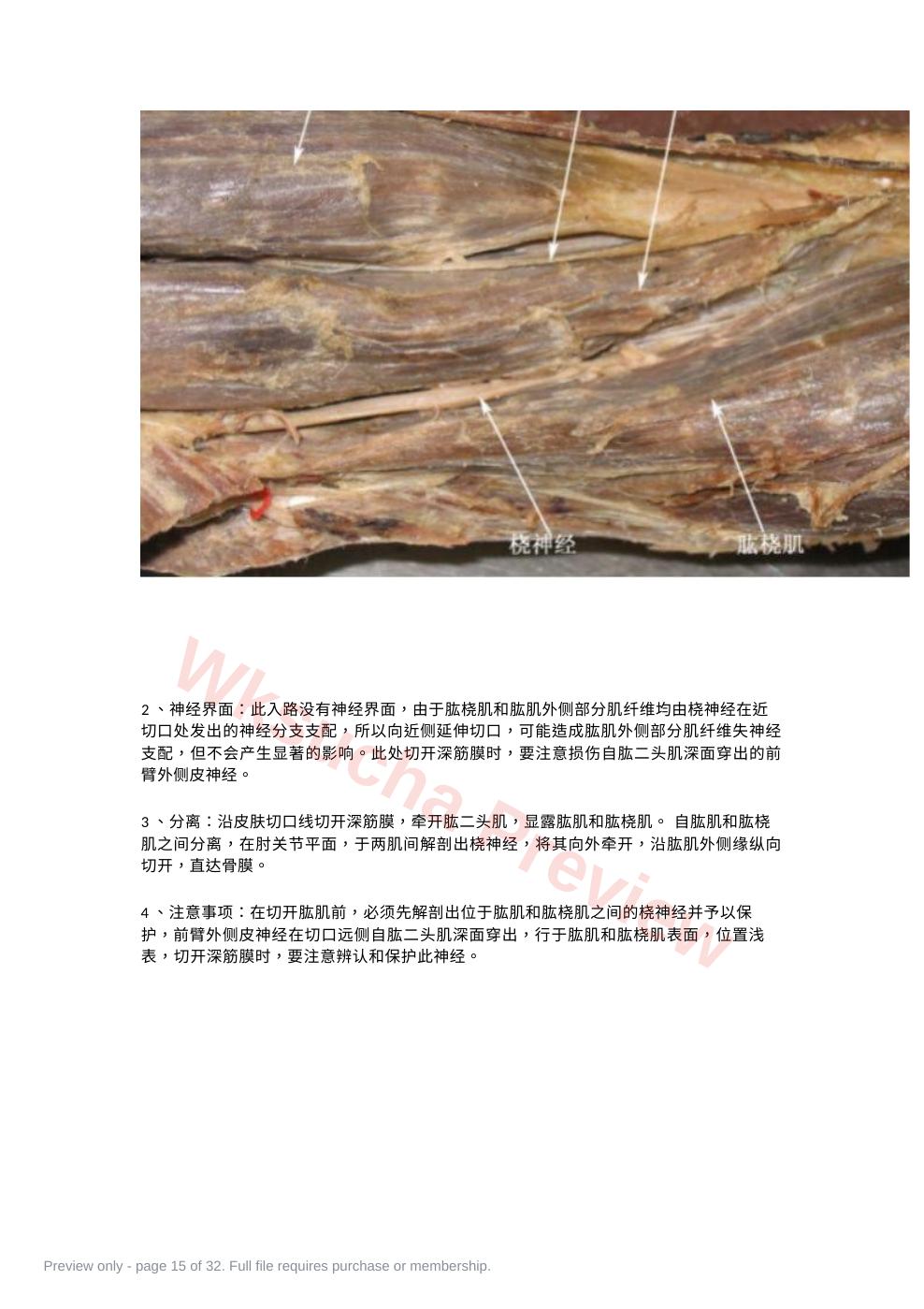预览第 15 页