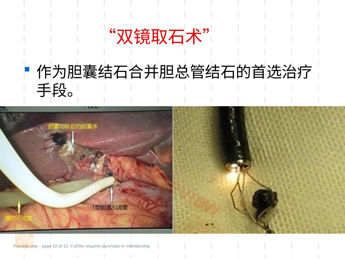 预览第 10 页