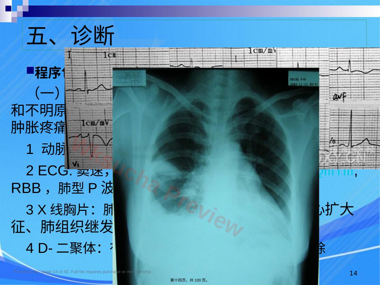 预览第 14 页