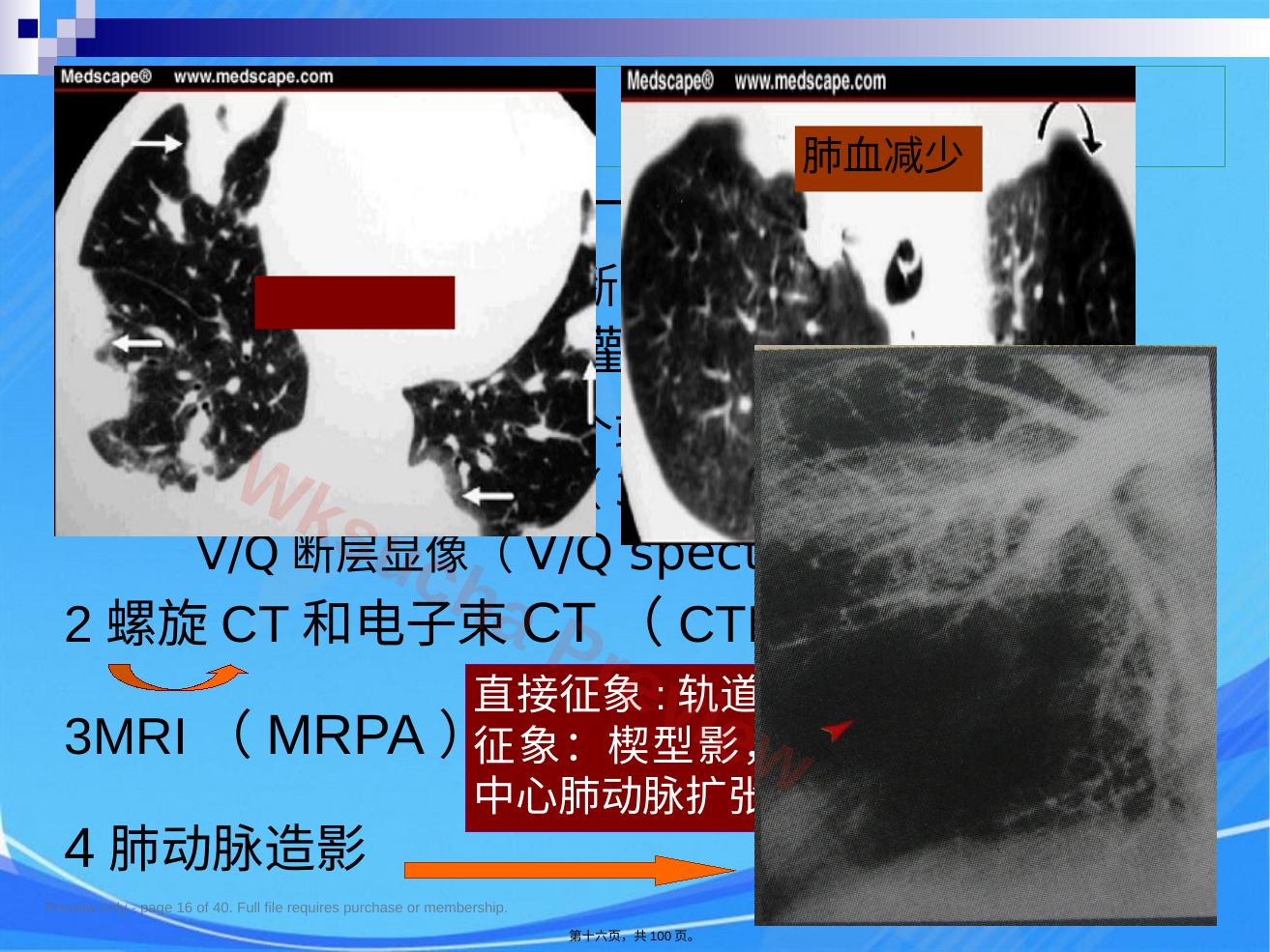 预览第 16 页