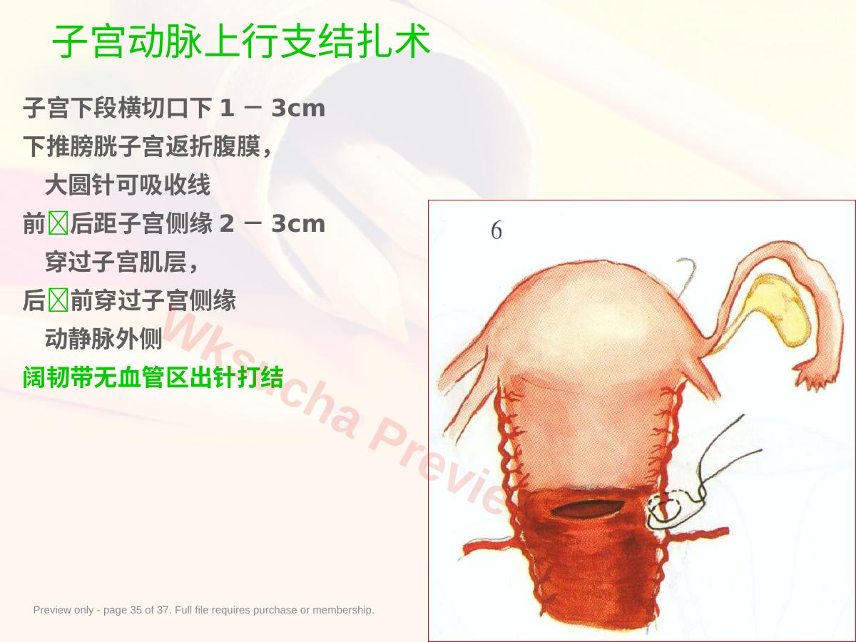预览第 35 页