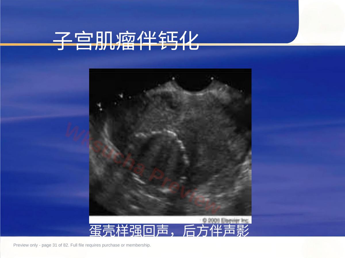 预览第 31 页