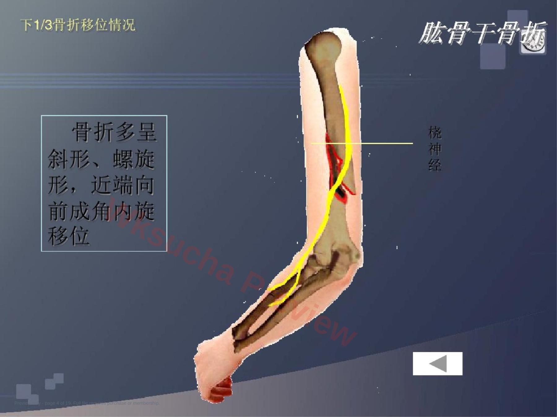 预览第 4 页
