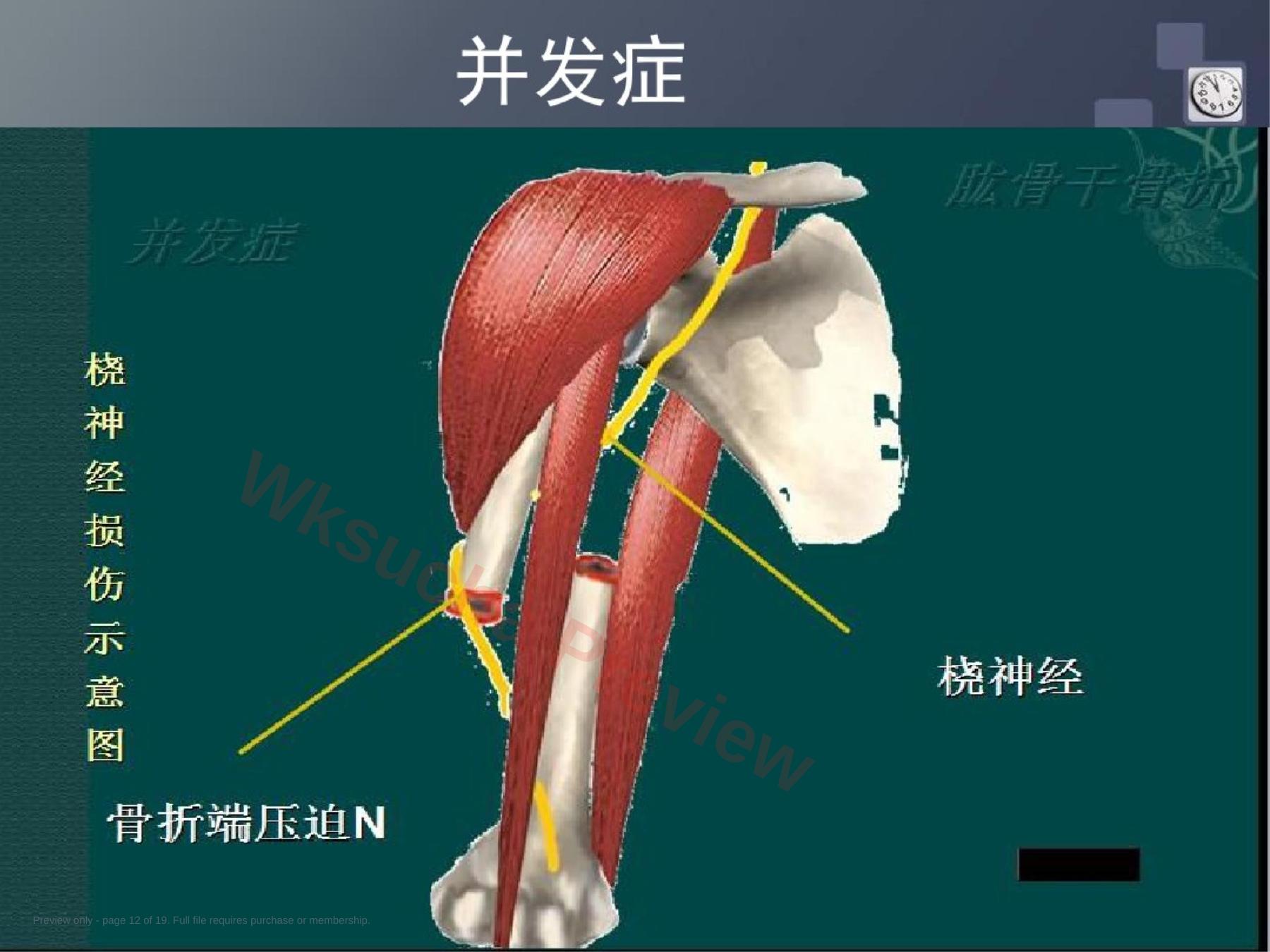 预览第 12 页
