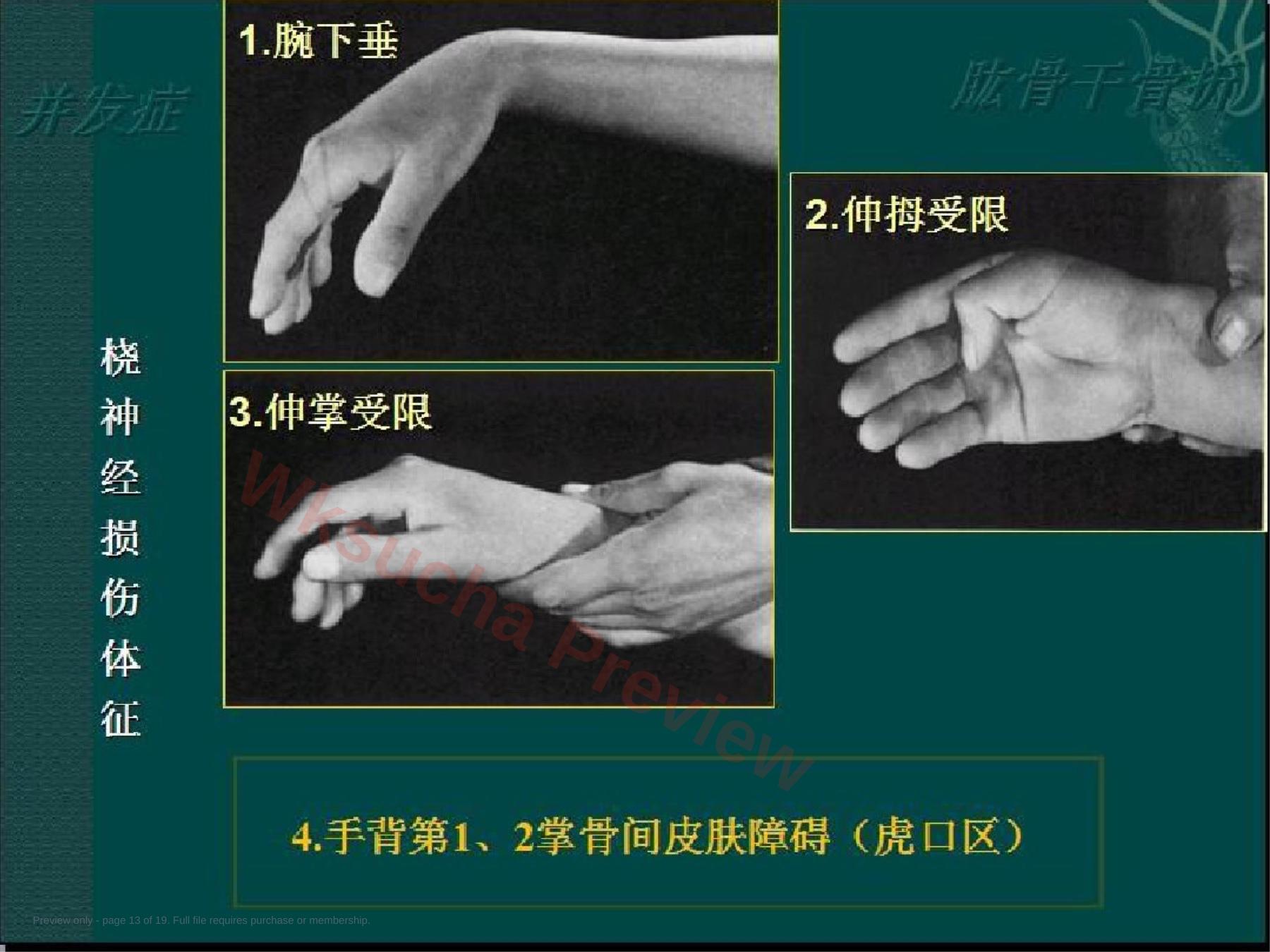 预览第 13 页