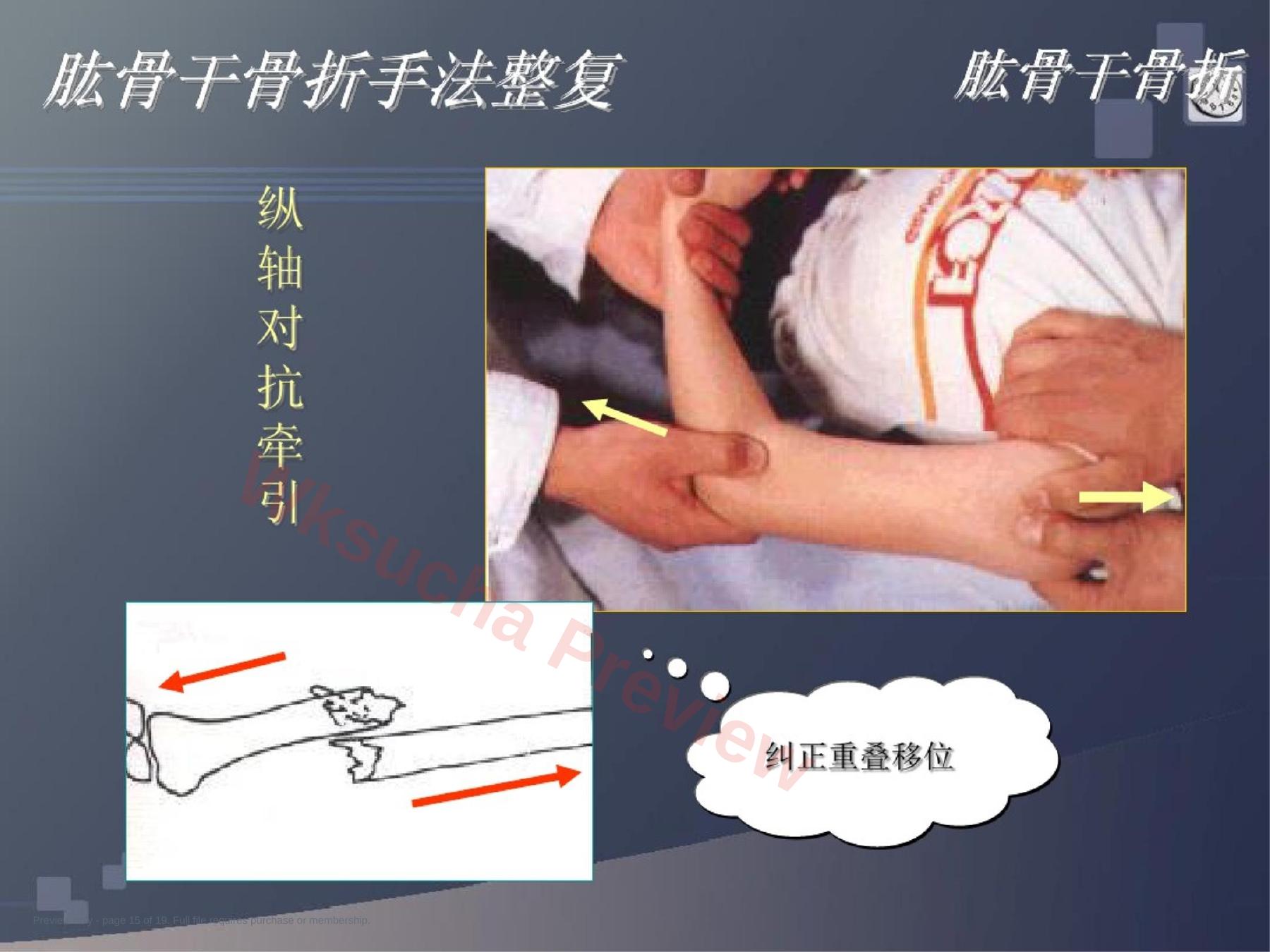 预览第 15 页