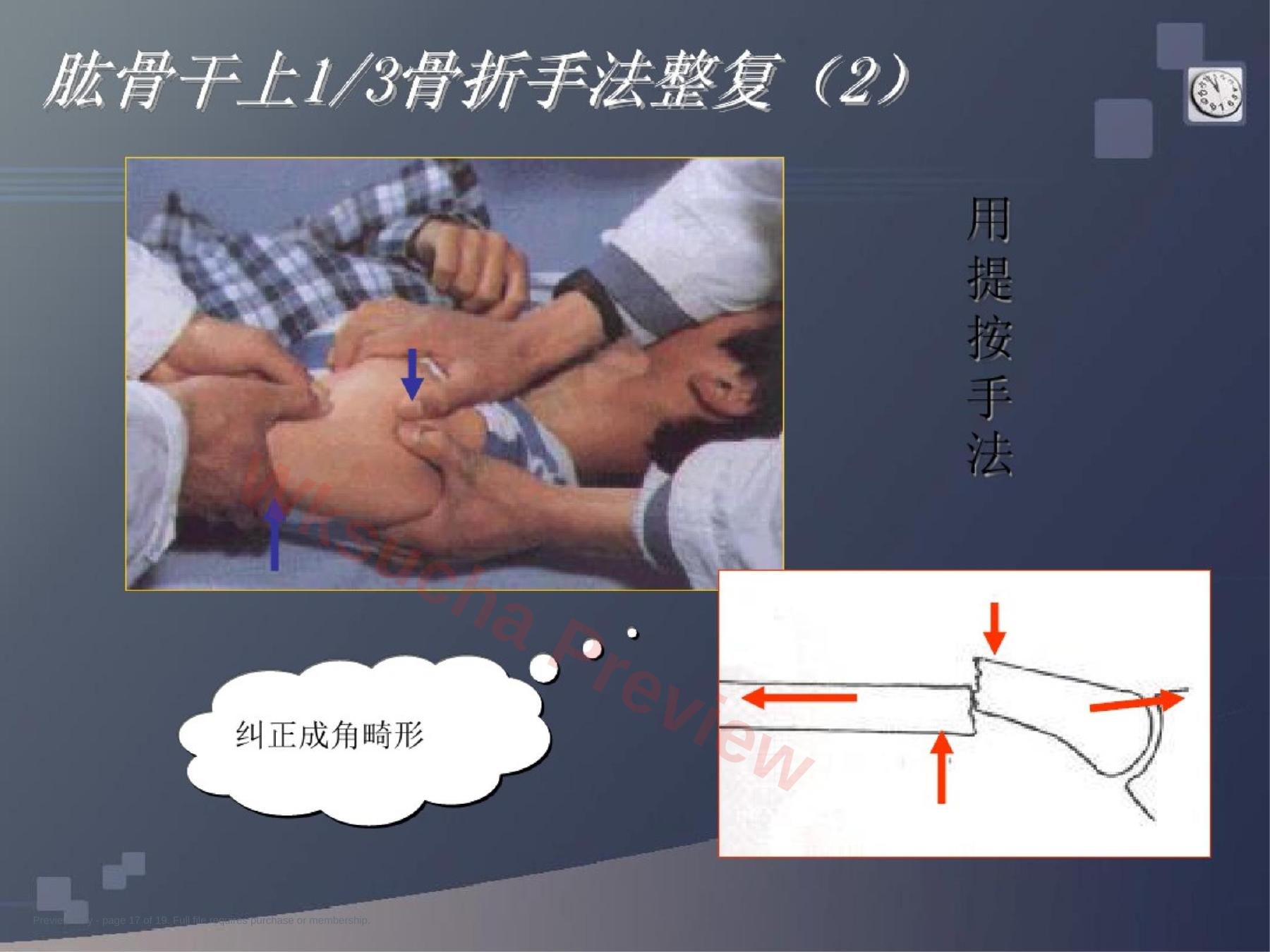 预览第 17 页