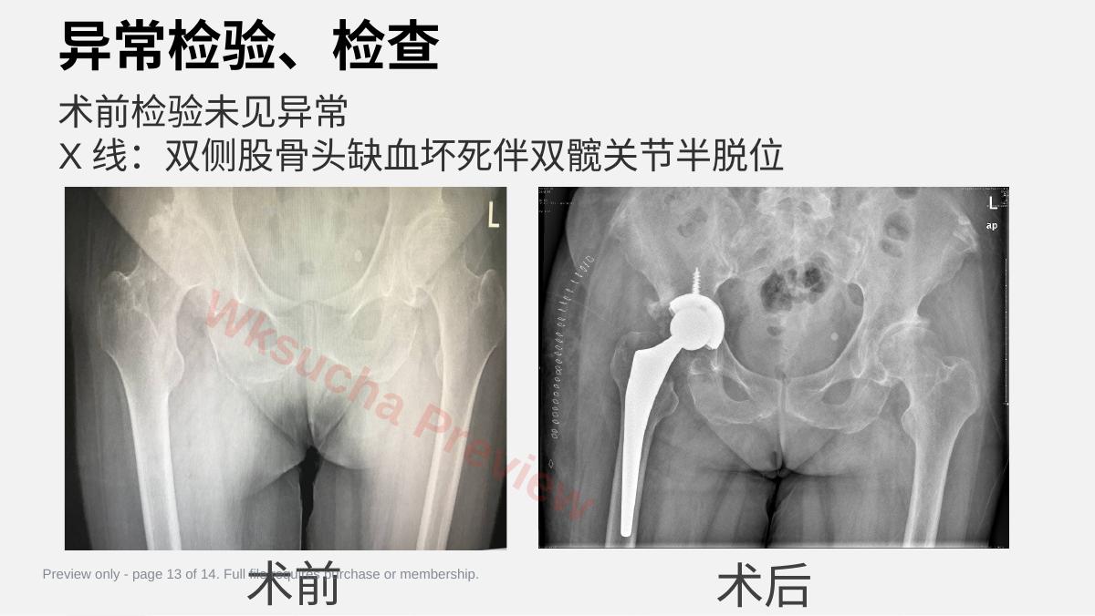 预览第 13 页