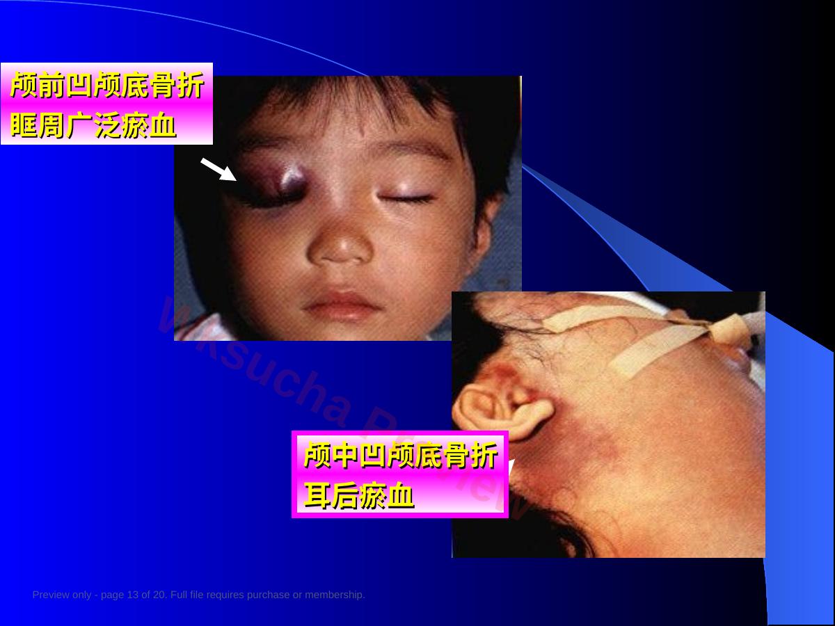 预览第 13 页