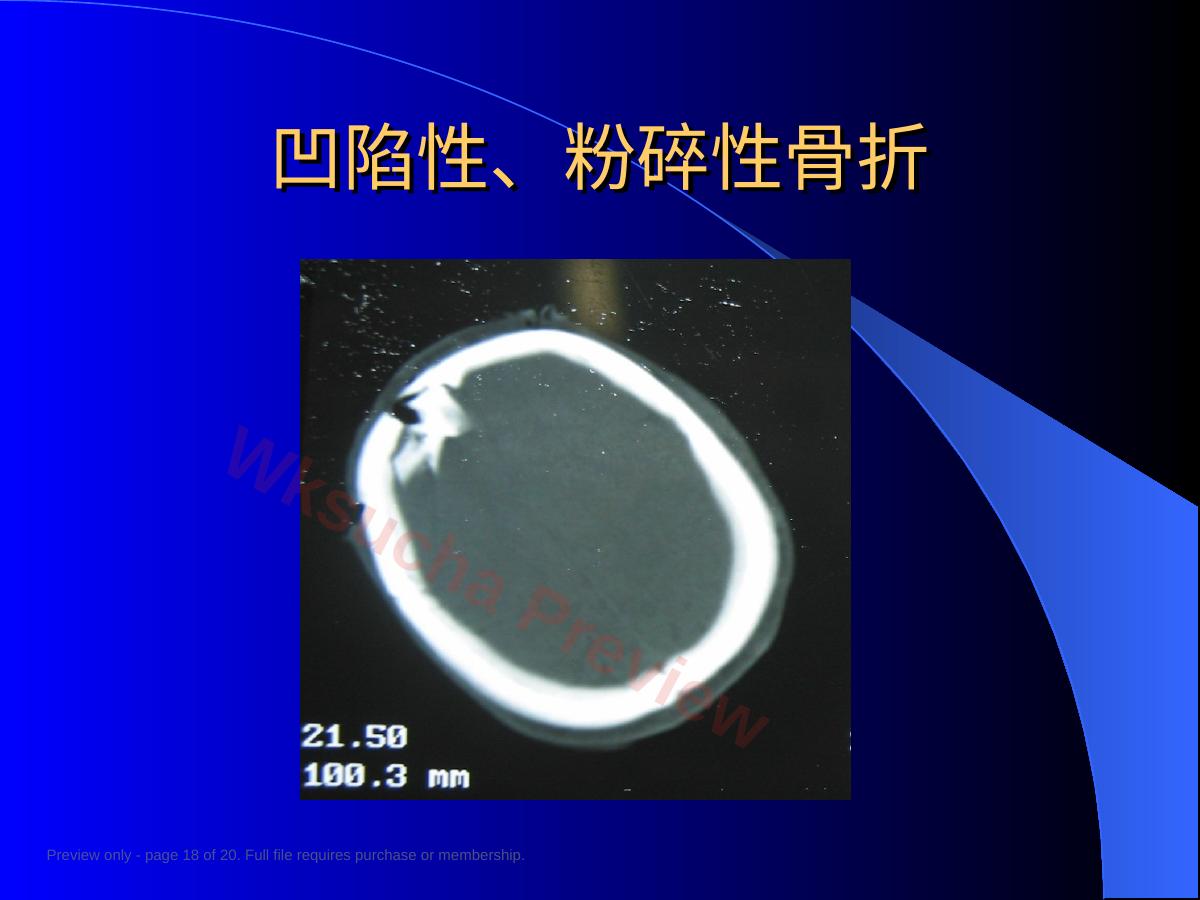 预览第 18 页