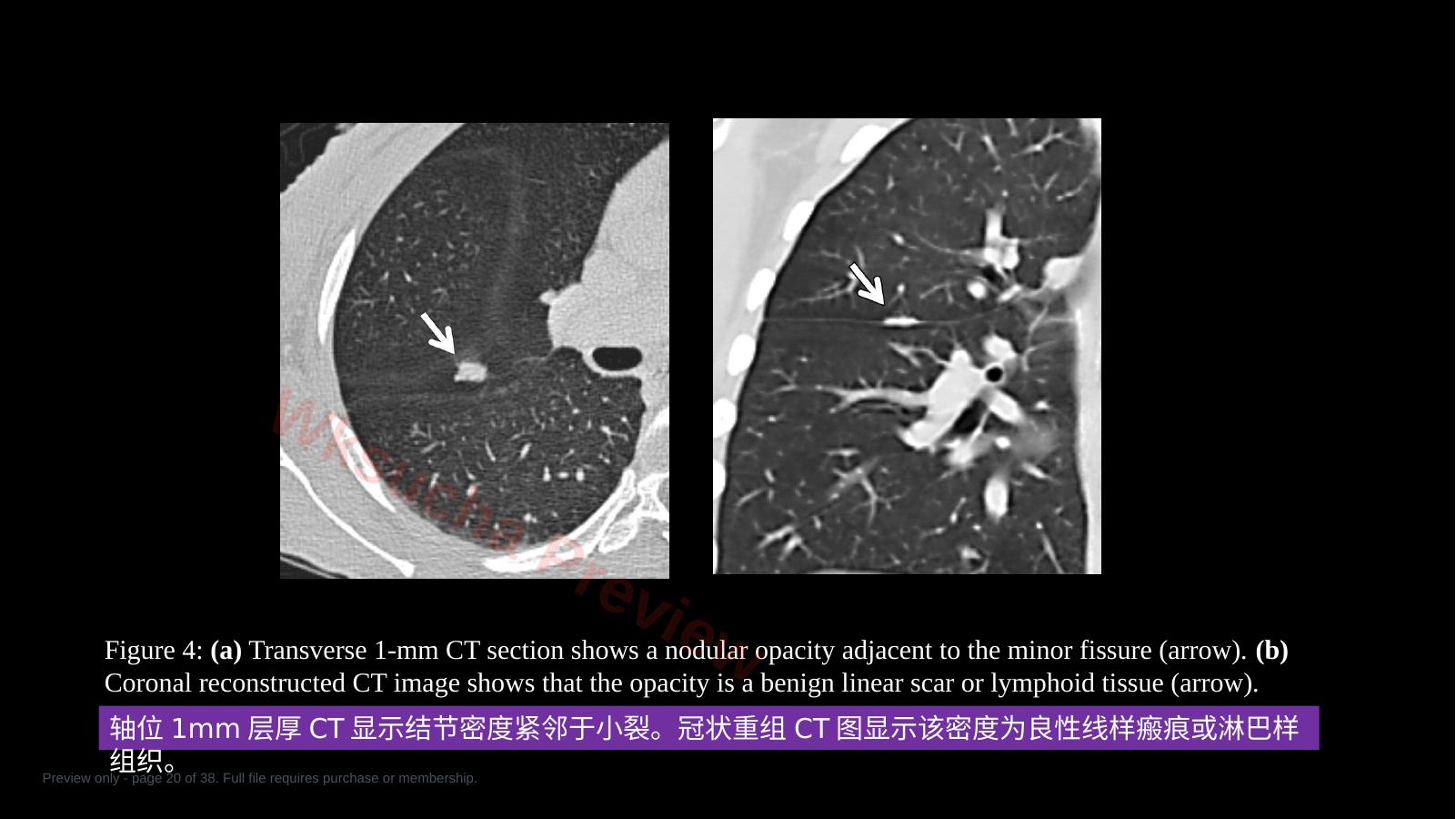 预览第 20 页