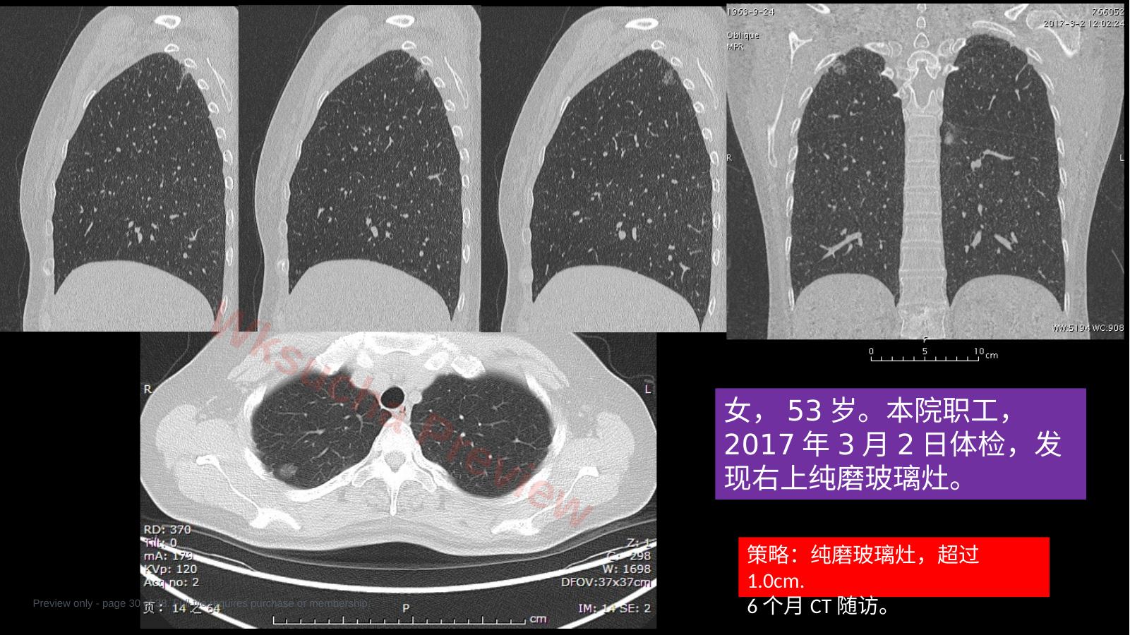 预览第 30 页