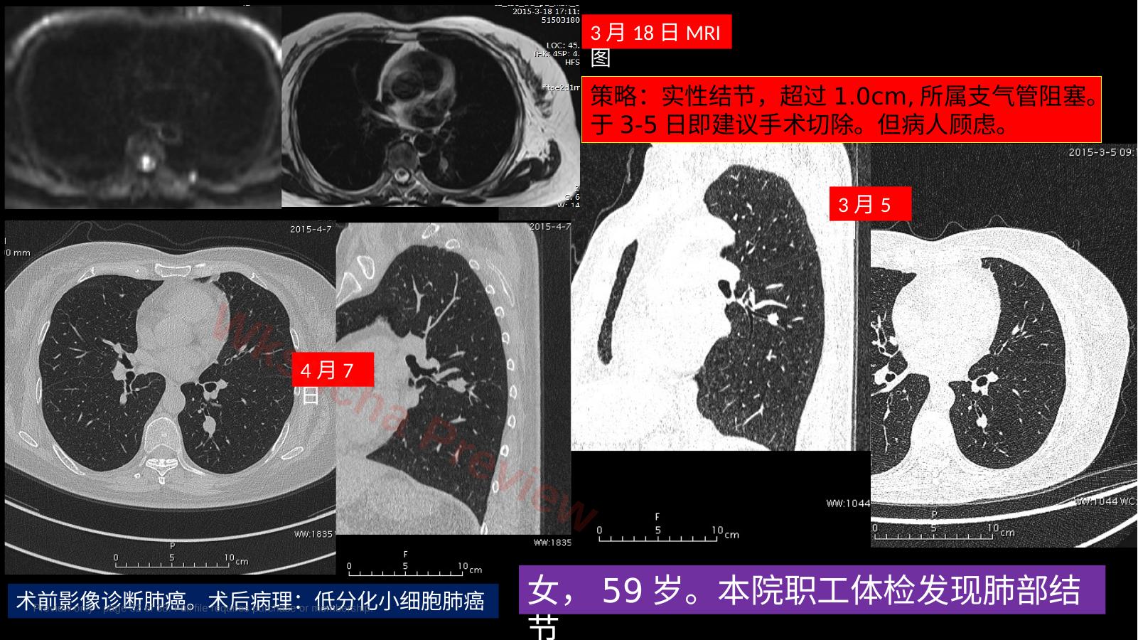 预览第 32 页