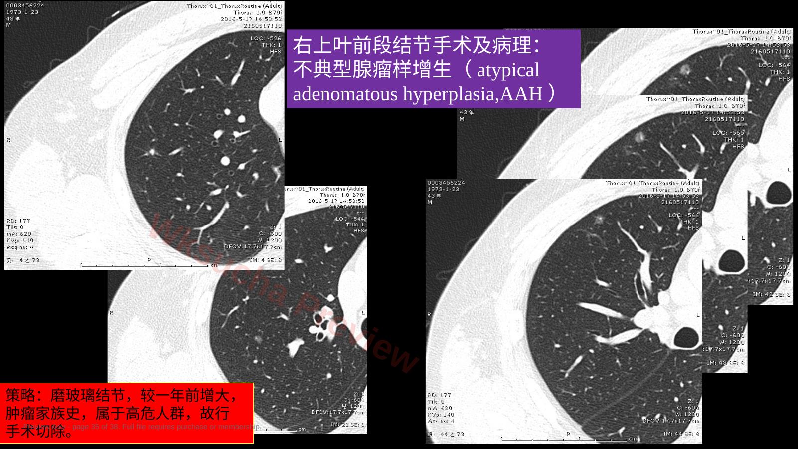 预览第 35 页