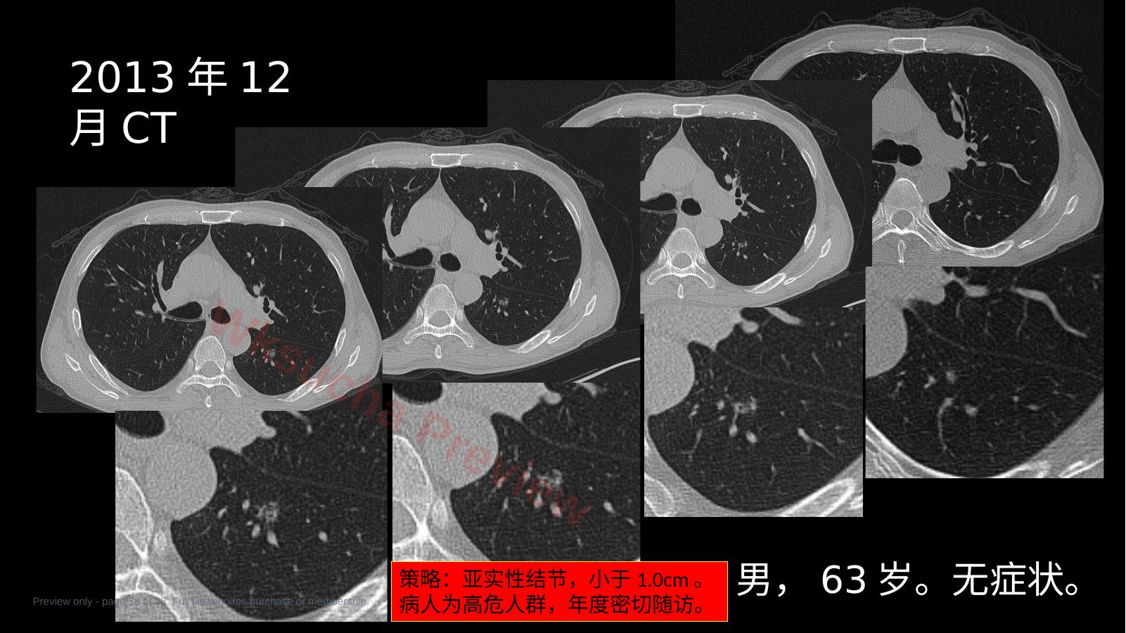 预览第 38 页