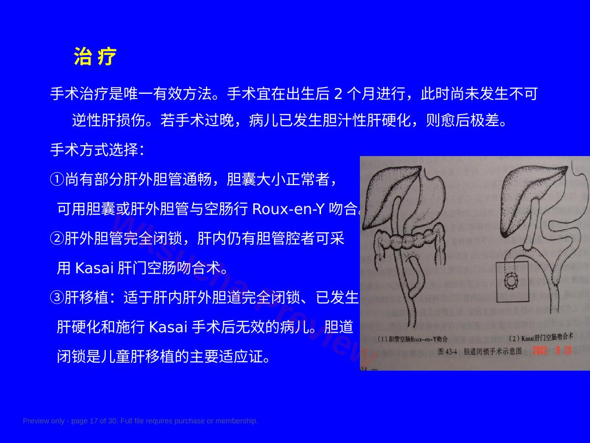 预览第 17 页