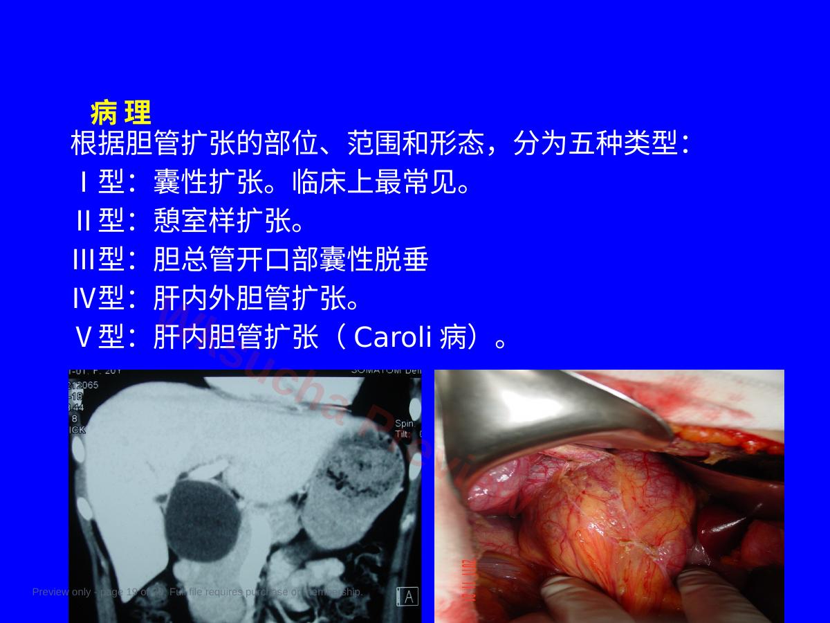 预览第 19 页