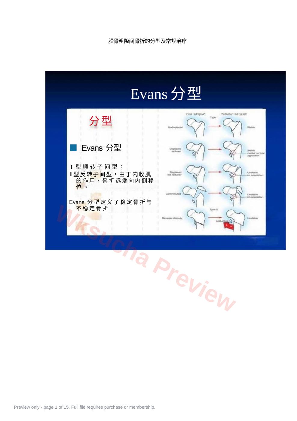 股骨粗隆间骨折的分型