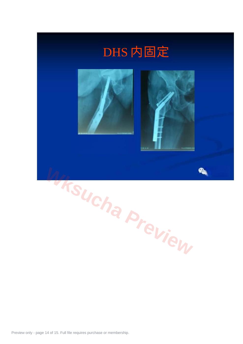 预览第 14 页