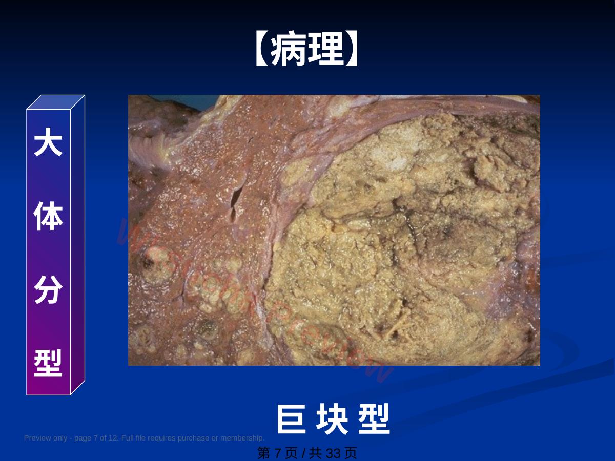 预览第 7 页