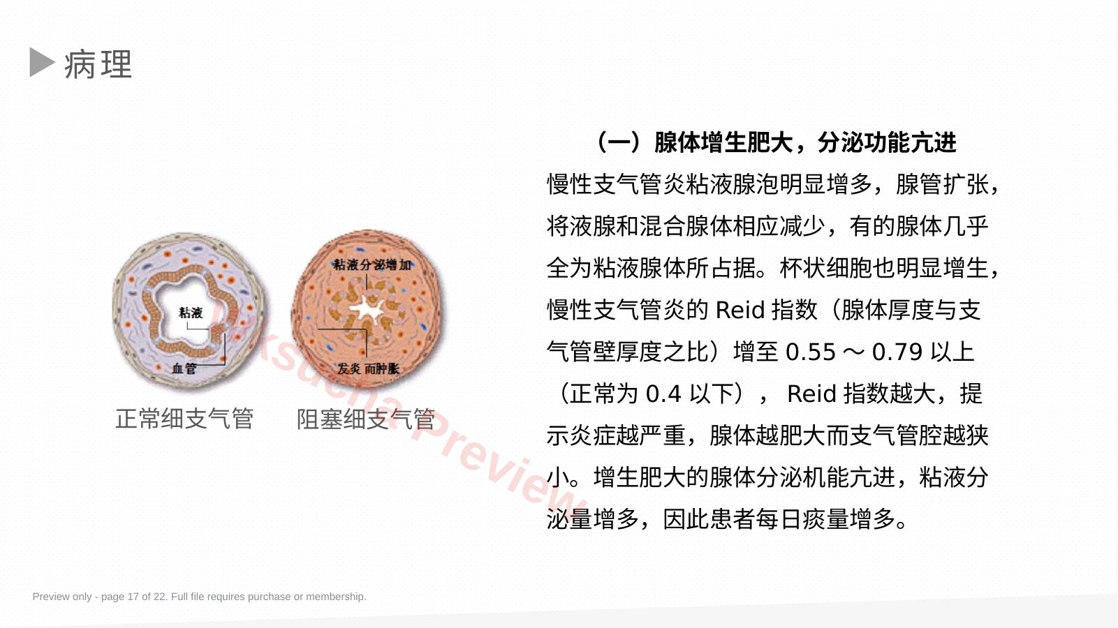 预览第 17 页