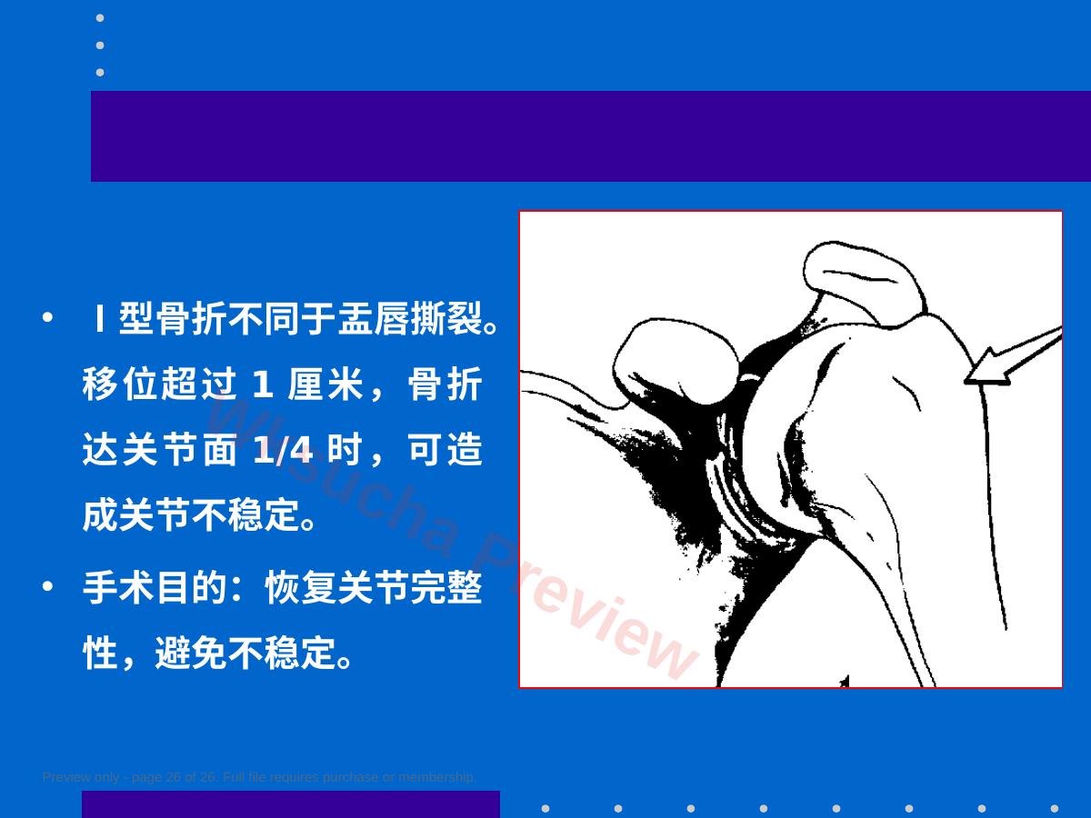 预览第 26 页