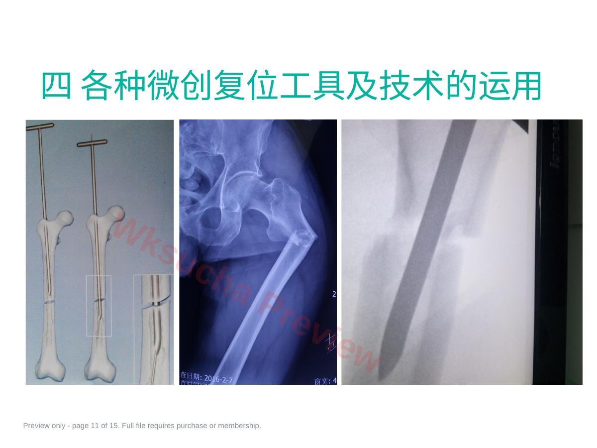 预览第 11 页