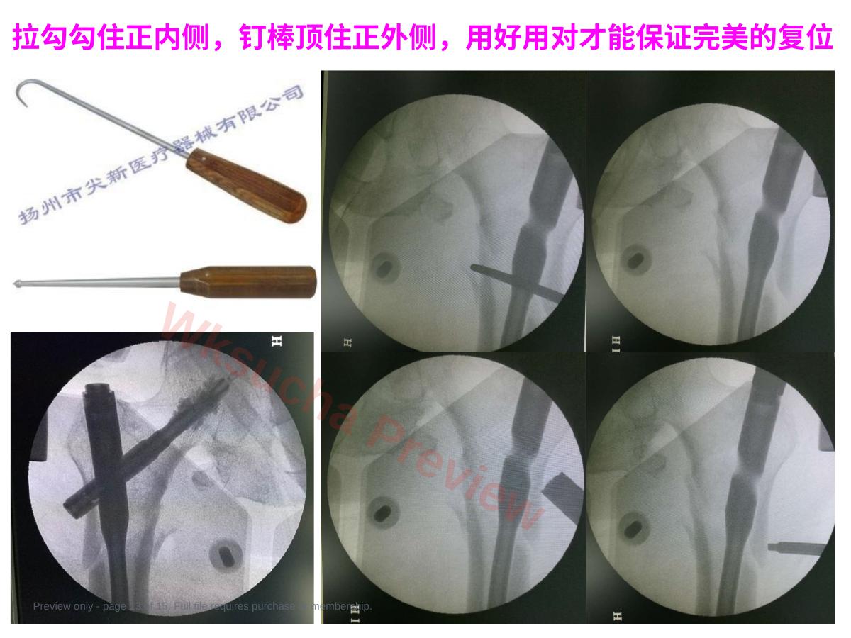 预览第 13 页
