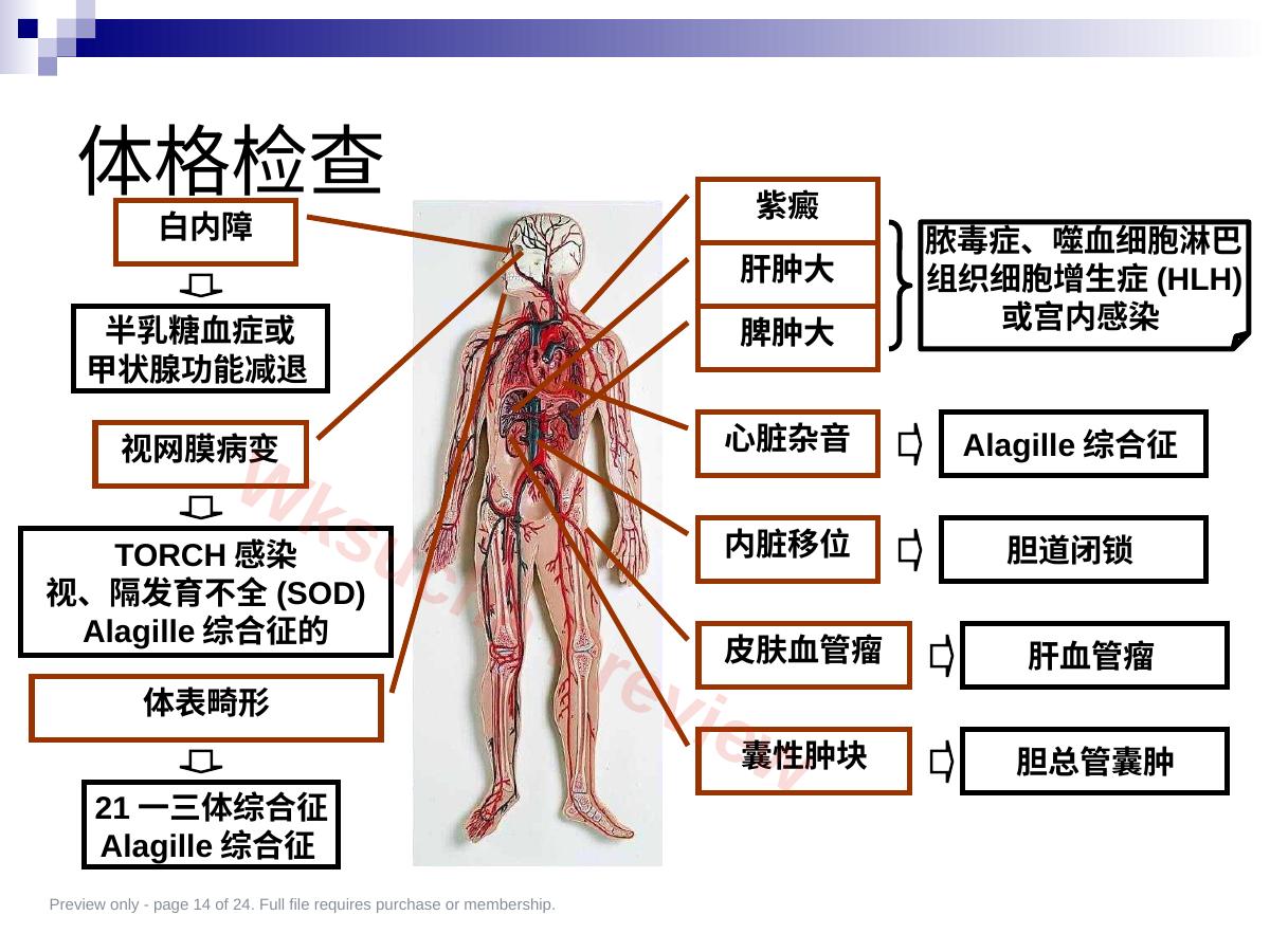 预览第 14 页