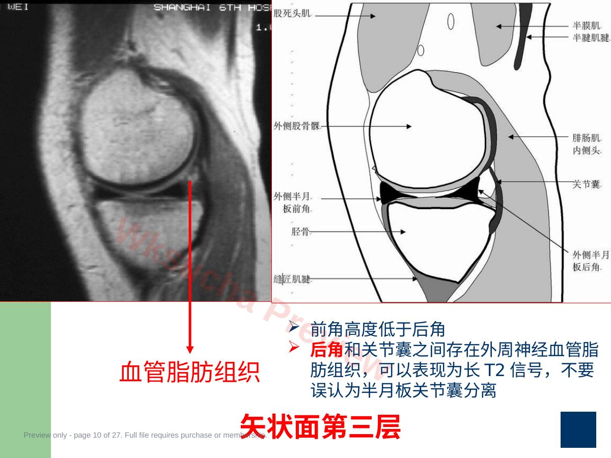预览第 10 页
