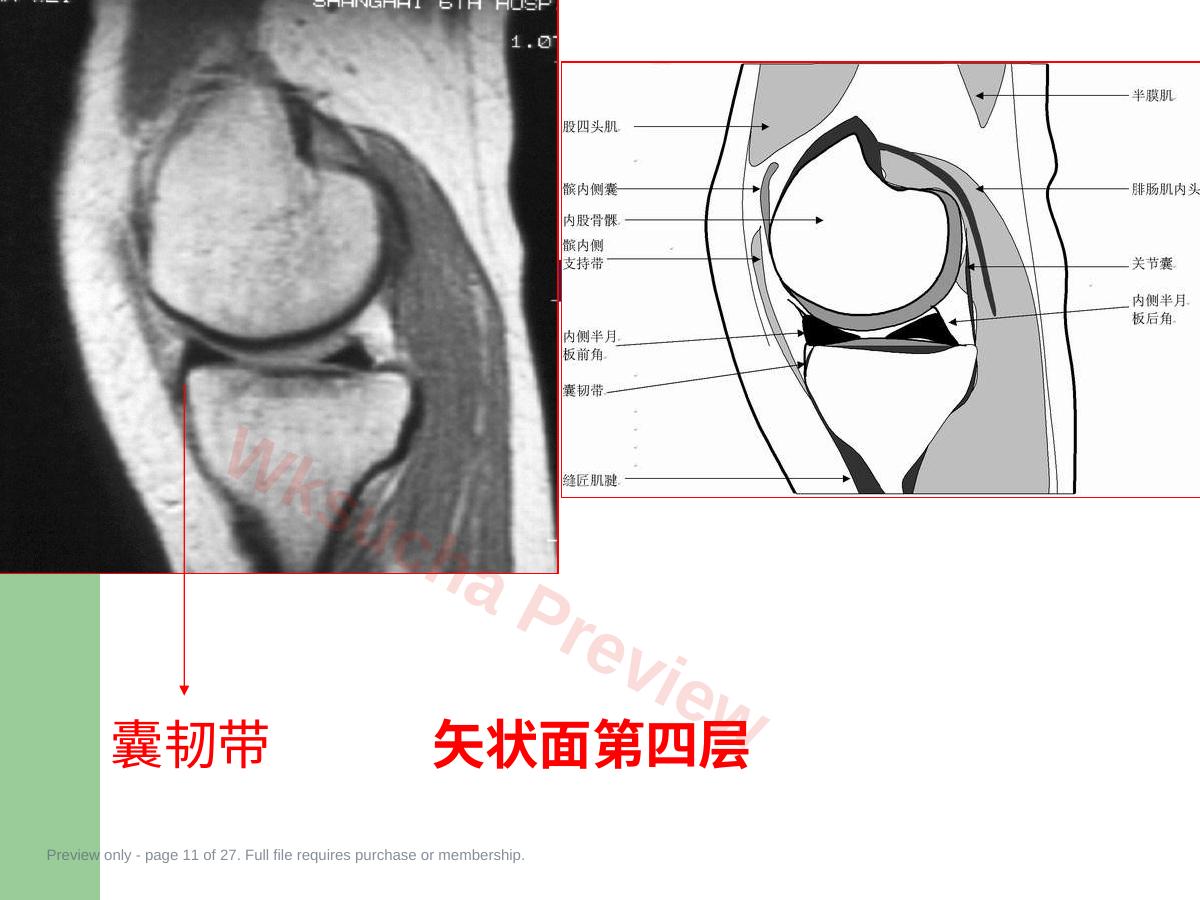 预览第 11 页