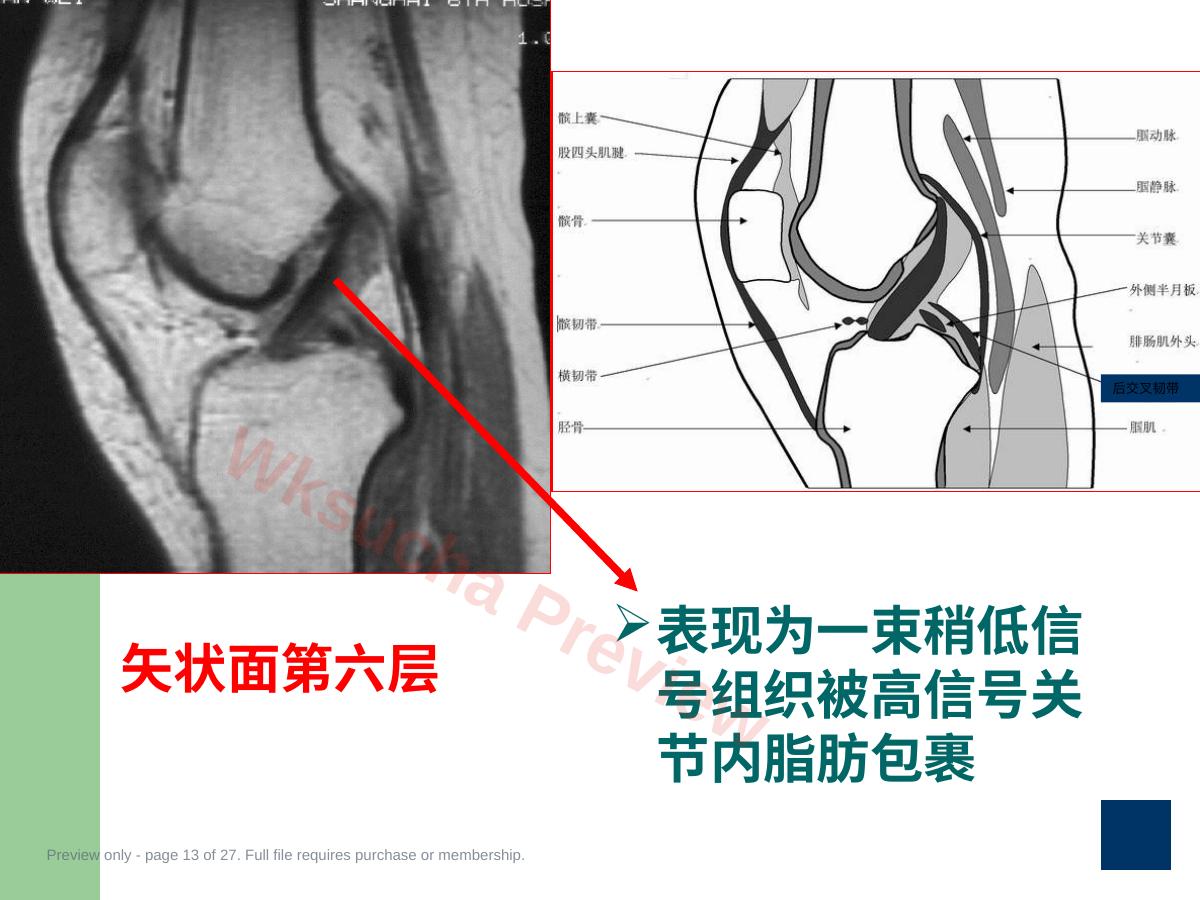 预览第 13 页