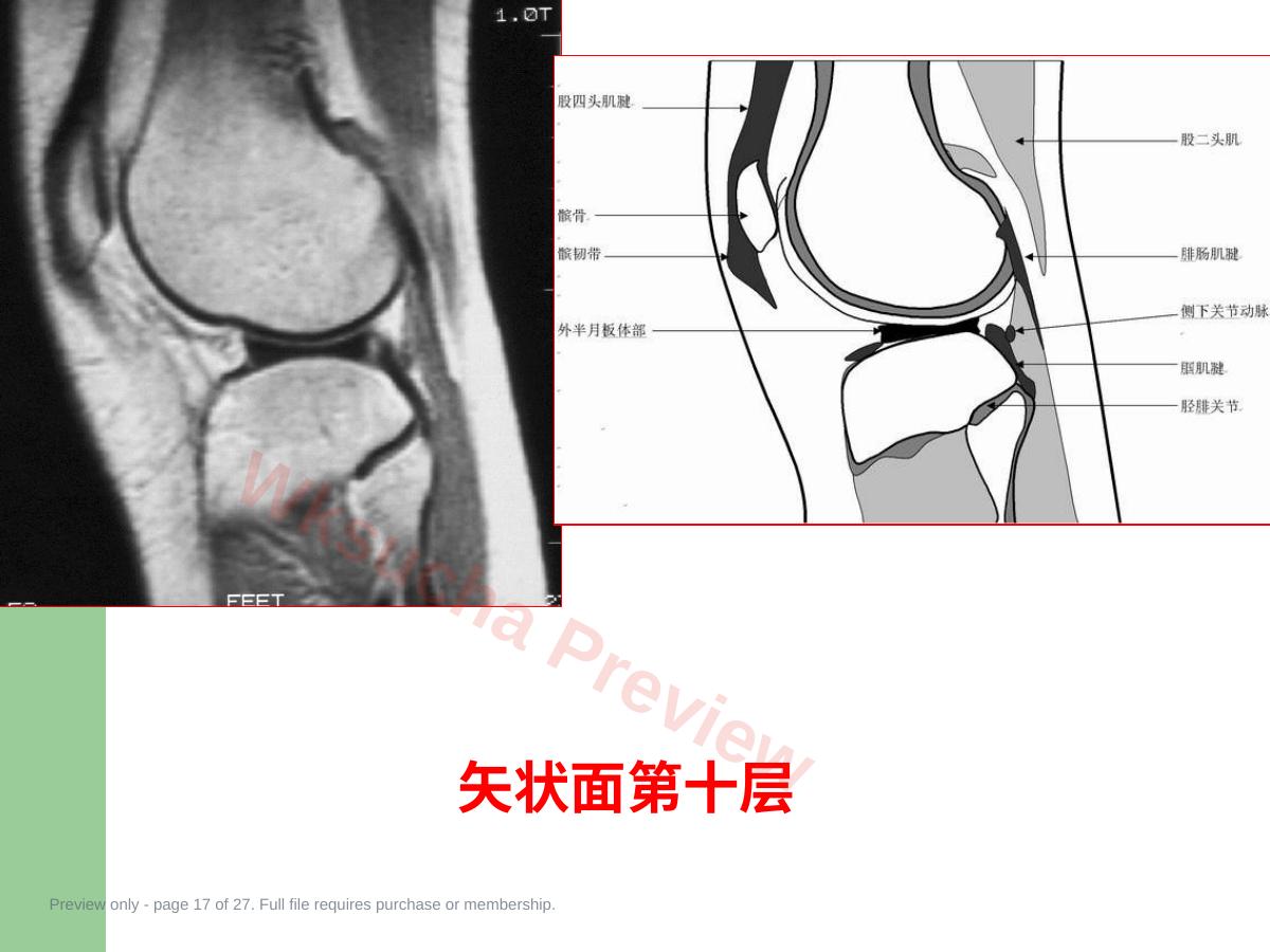 预览第 17 页