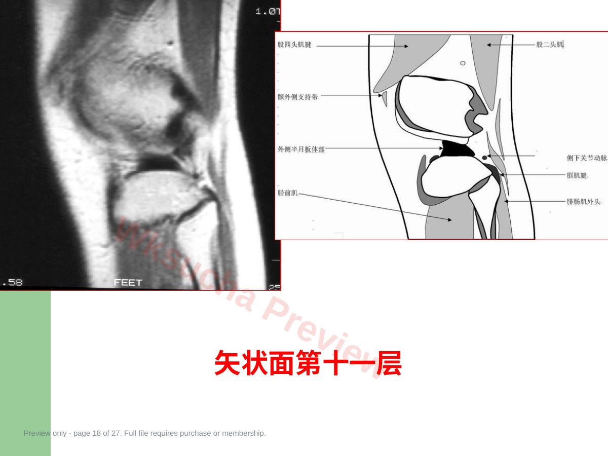 预览第 18 页