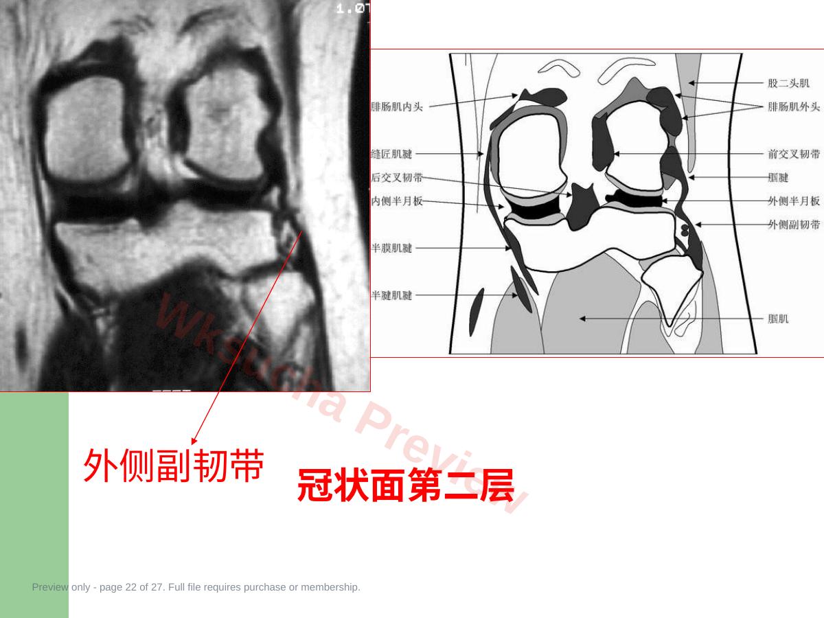 预览第 22 页