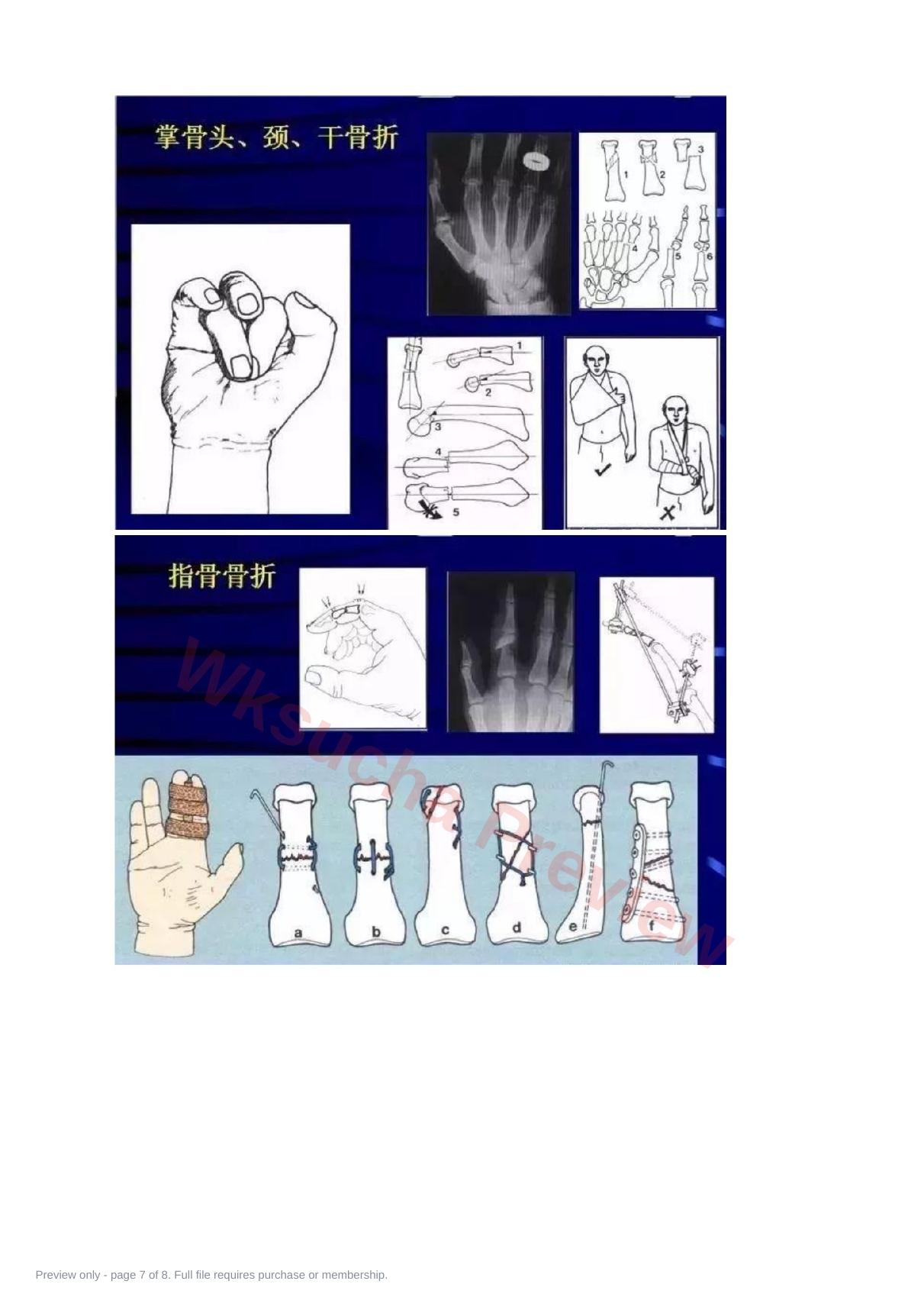 预览第 7 页