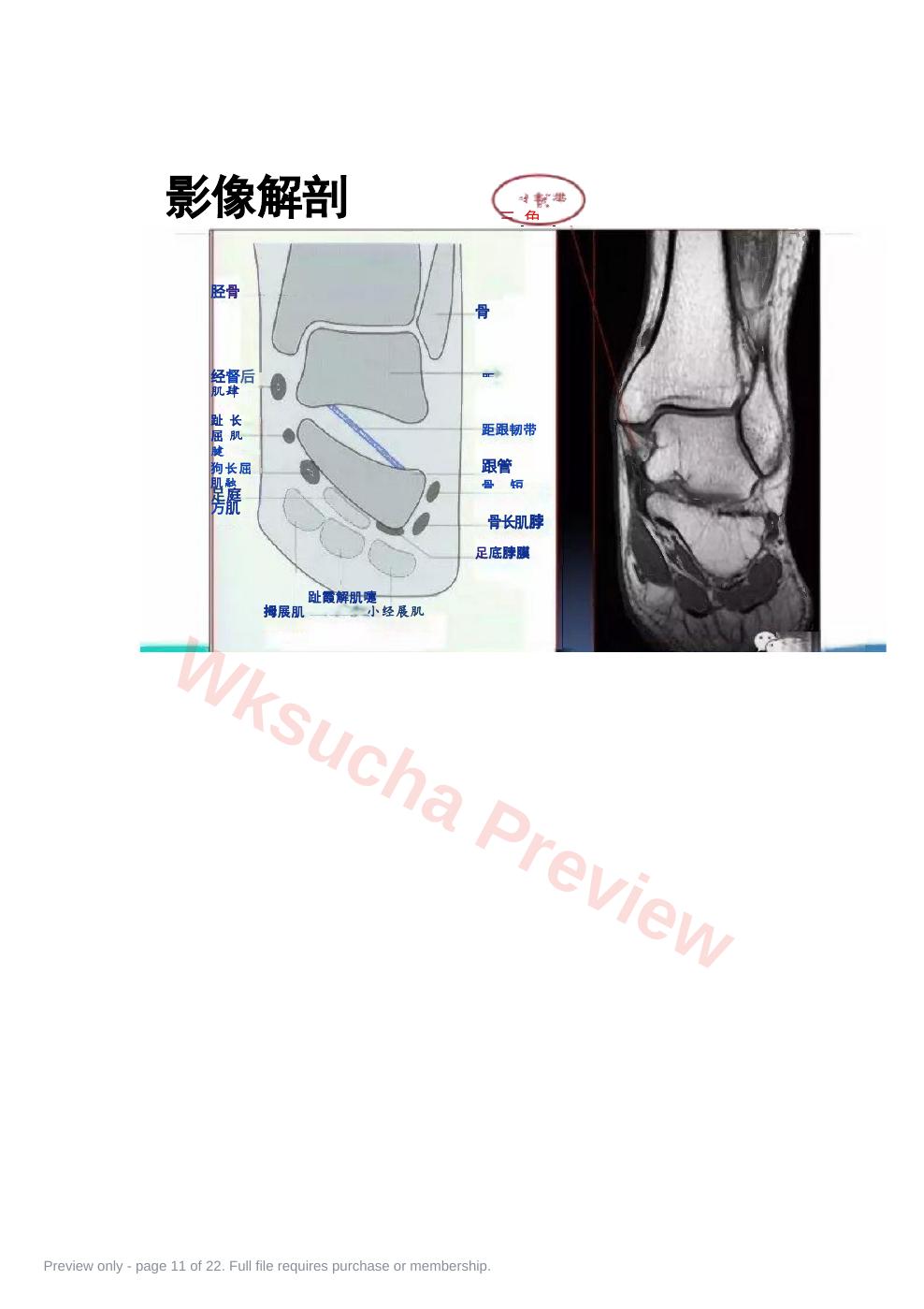 预览第 11 页