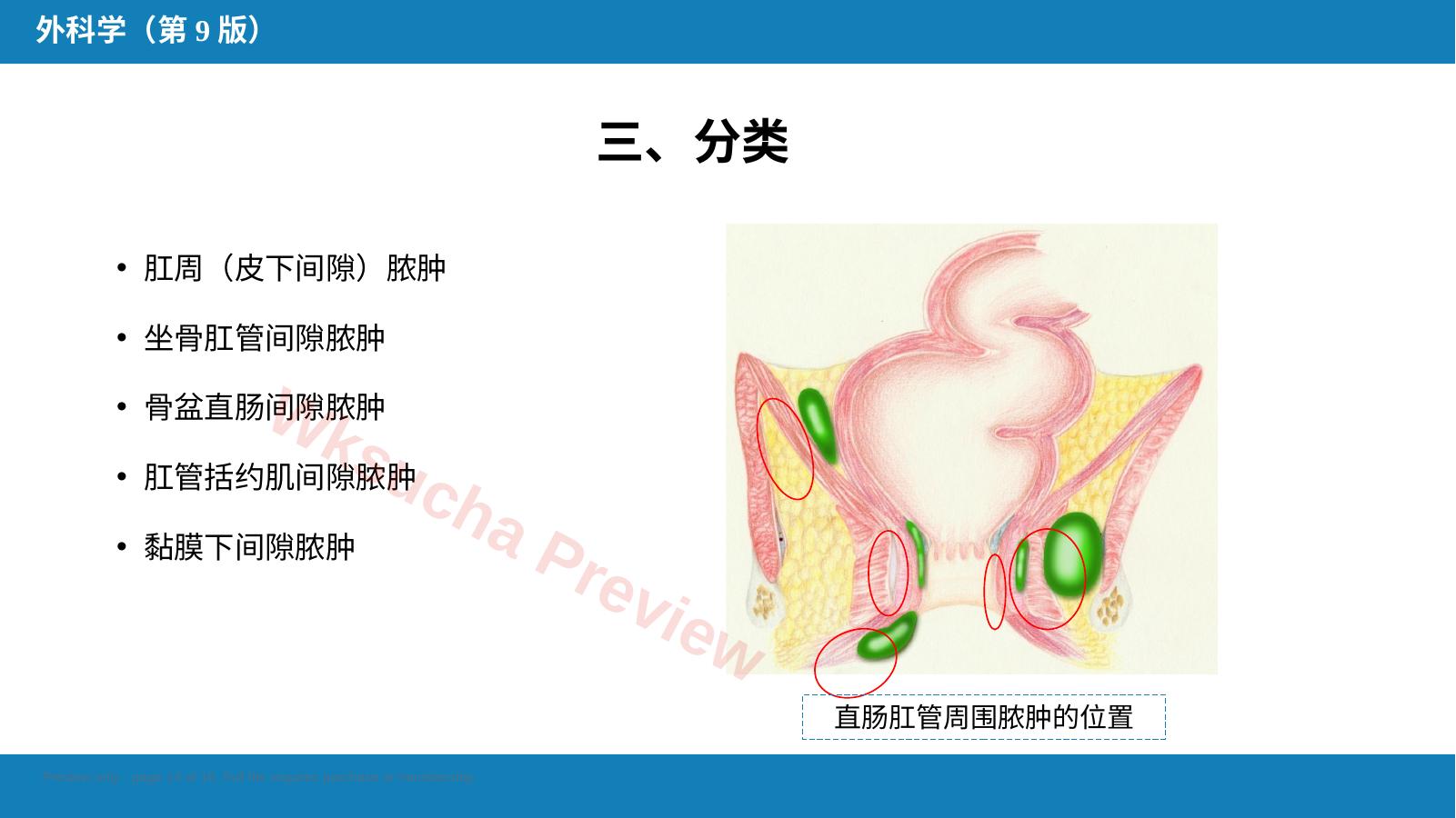 预览第 14 页