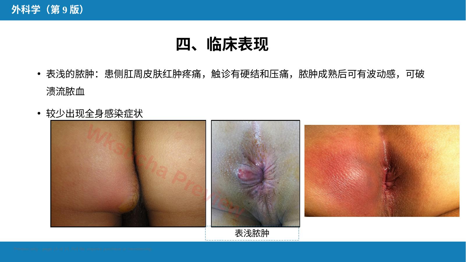 预览第 15 页