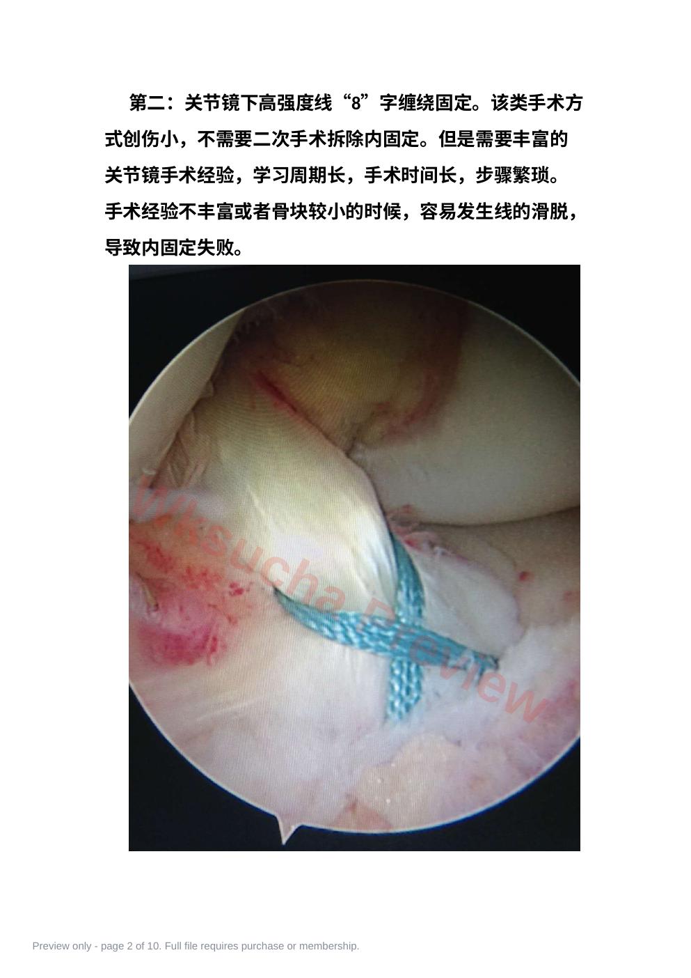 预览第 2 页