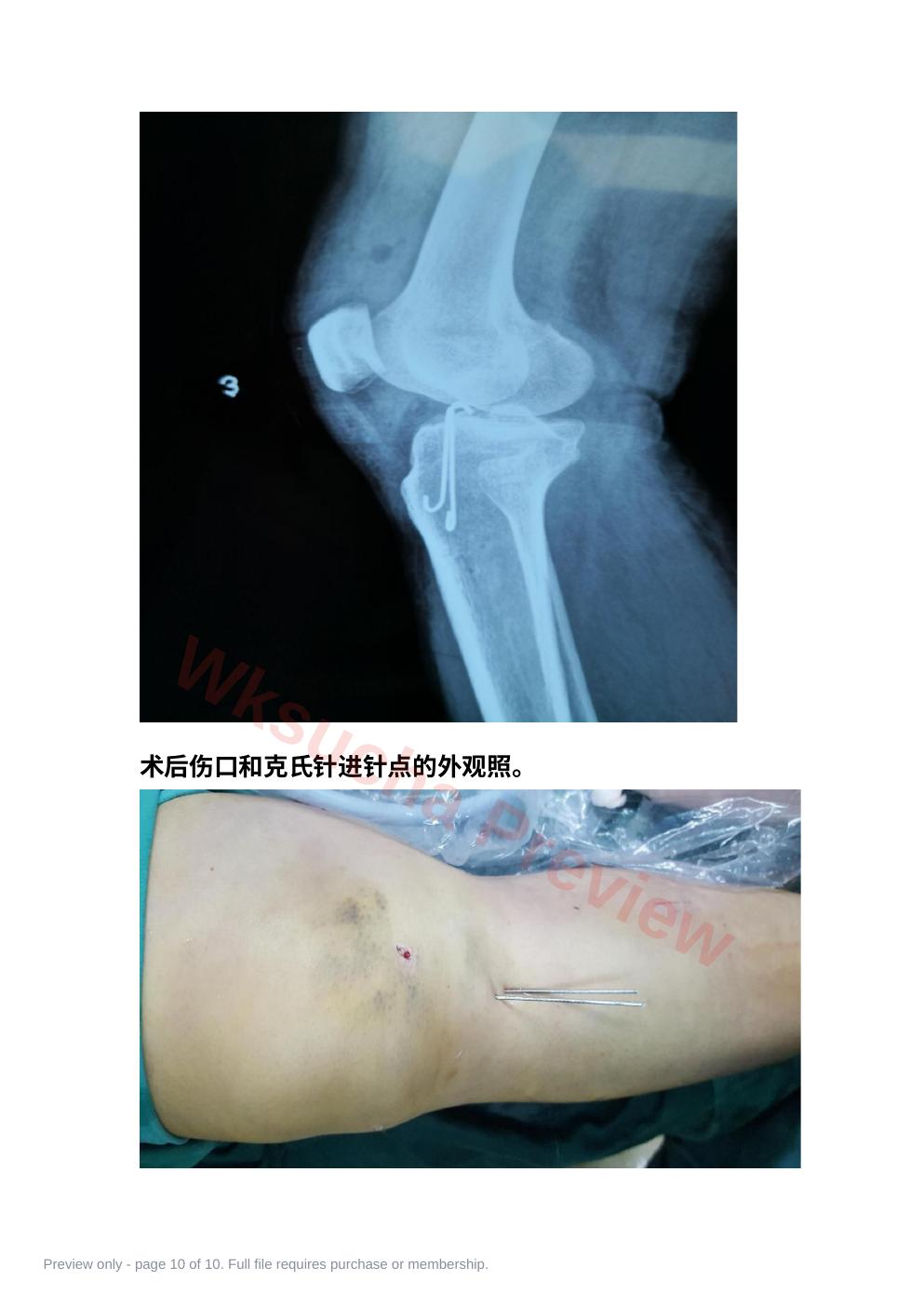 预览第 10 页