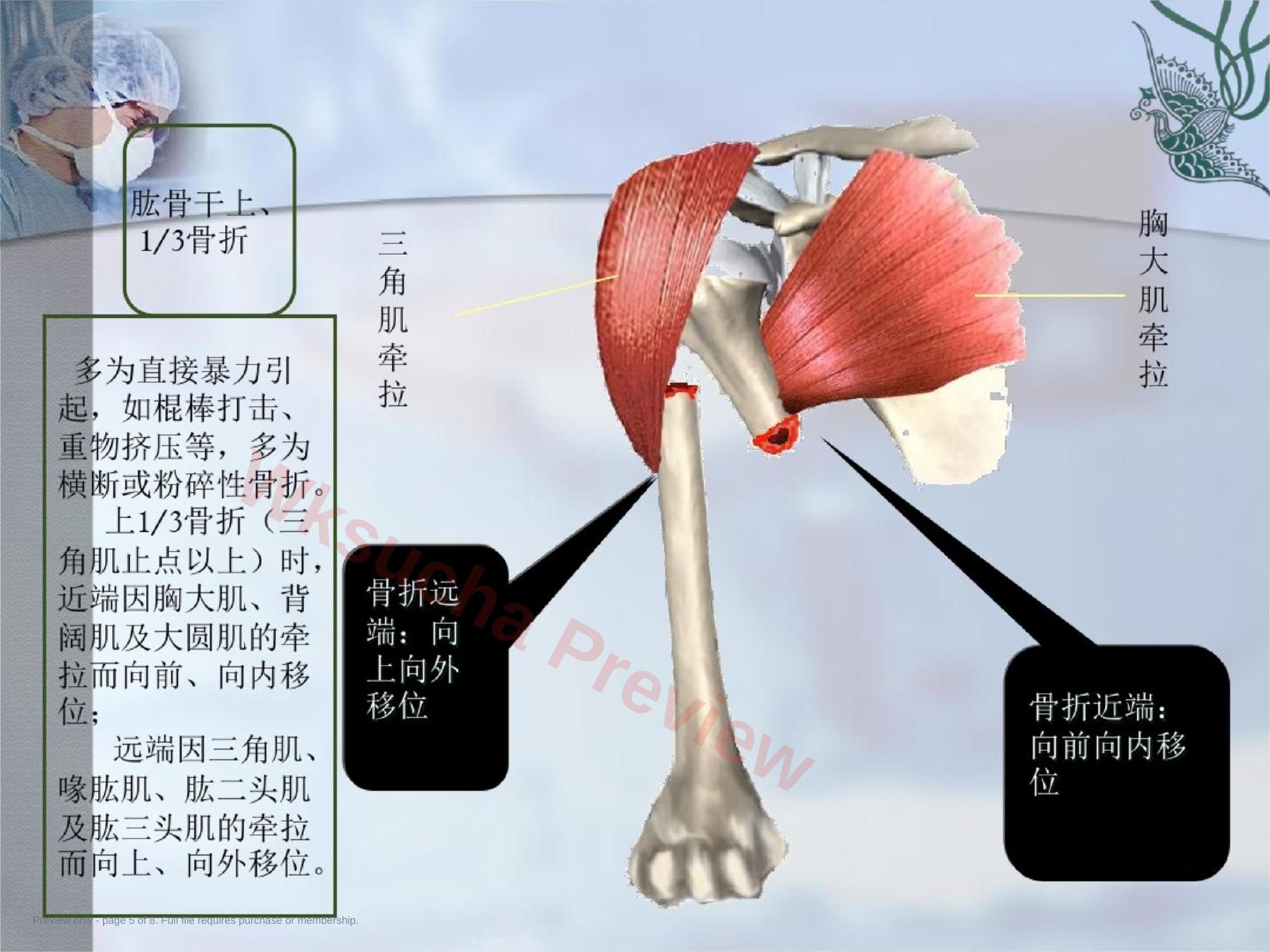 预览第 5 页